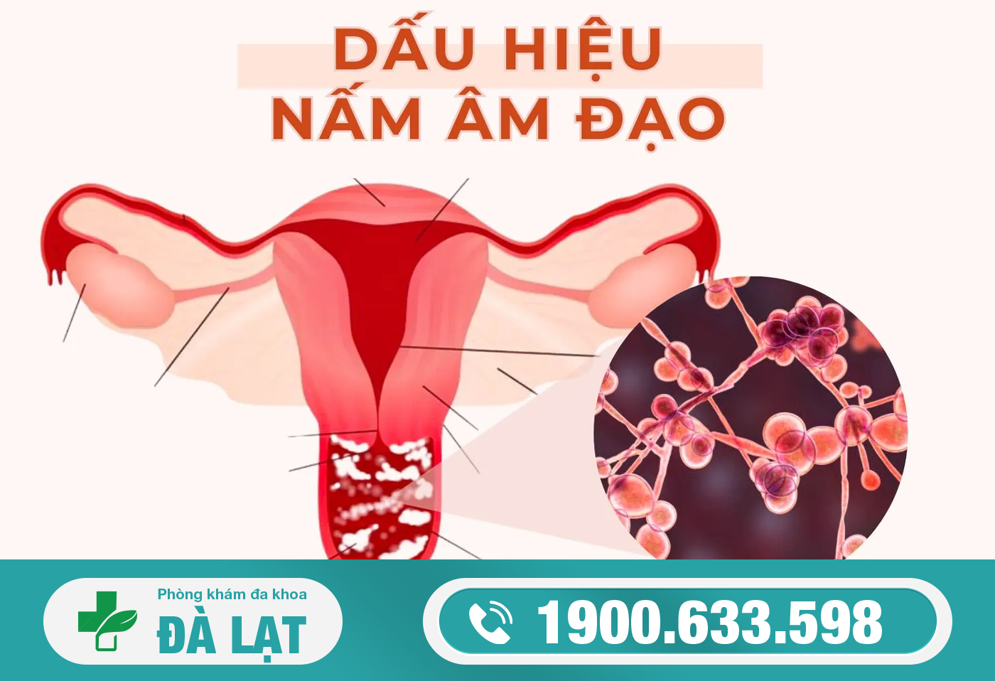 Hình ảnh minh họa